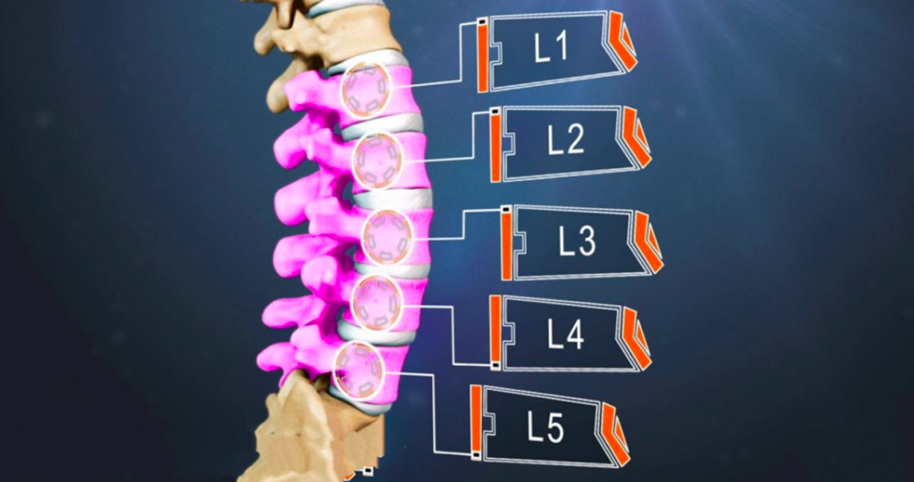The Lumbar spine with the 5 vertebrae and the spinal disks. This is often called the lower back, the region where most people experience back pain.