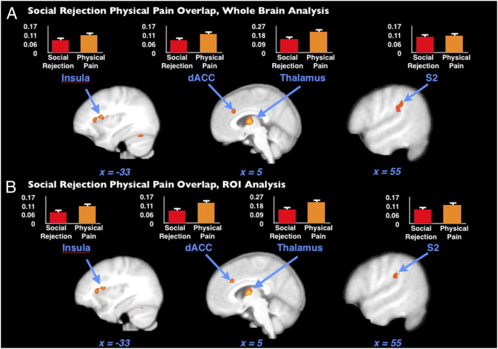 Social rejection and physical pain overlap (Kross, 2011) - Chronic pain guide by Angelos Georgakis